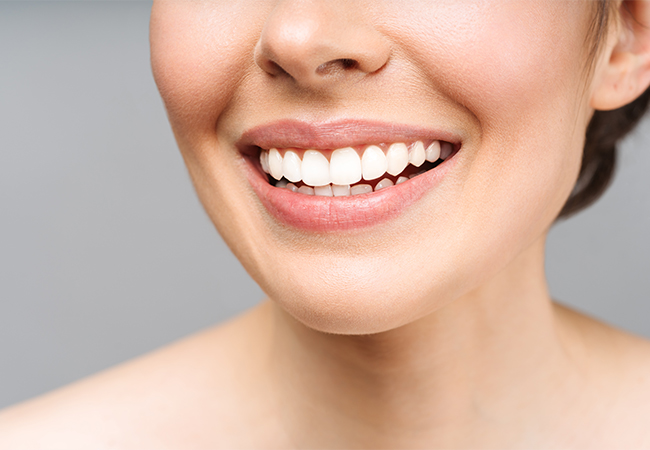 woman smiling with white teeth dental implants