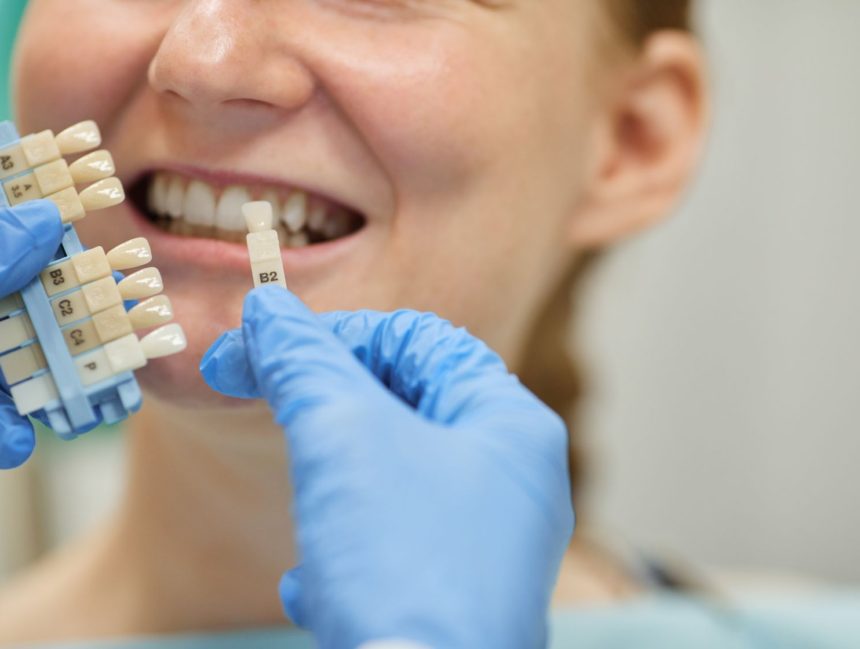 Dental Implants vs. Bridge