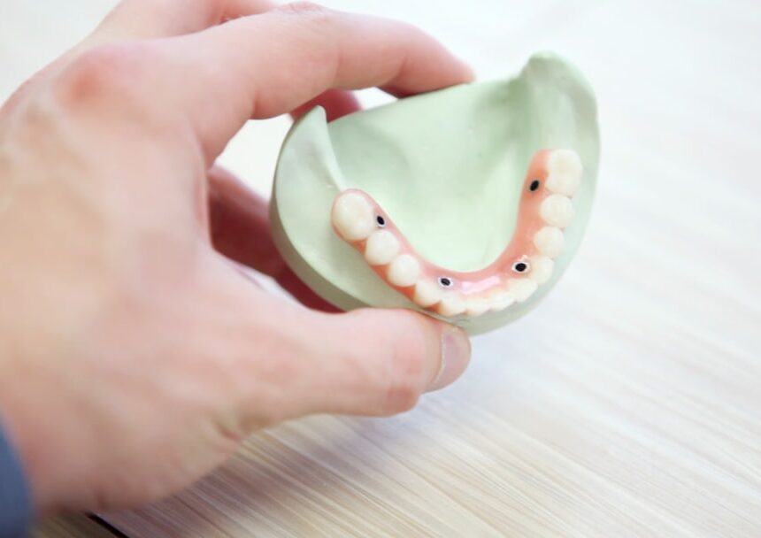 Affordable Same Day Dental Implants: A Guide to Finding the Best Deals Near You