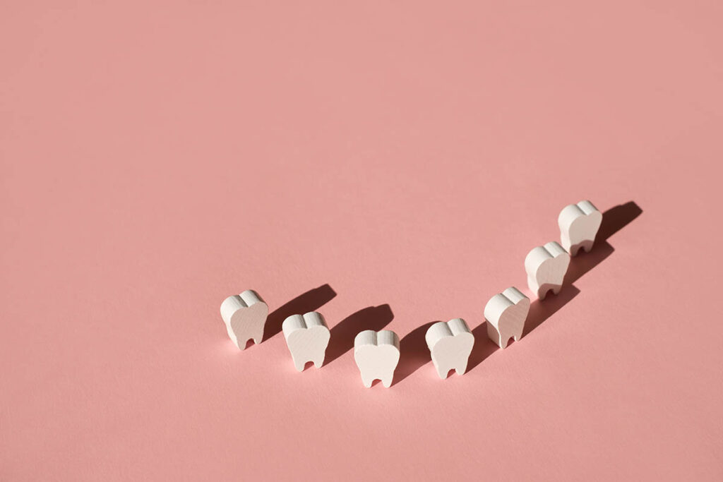 what to eat after wisdom teeth removal