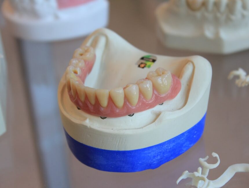 What to Do When Your Dentures Get Wobbly