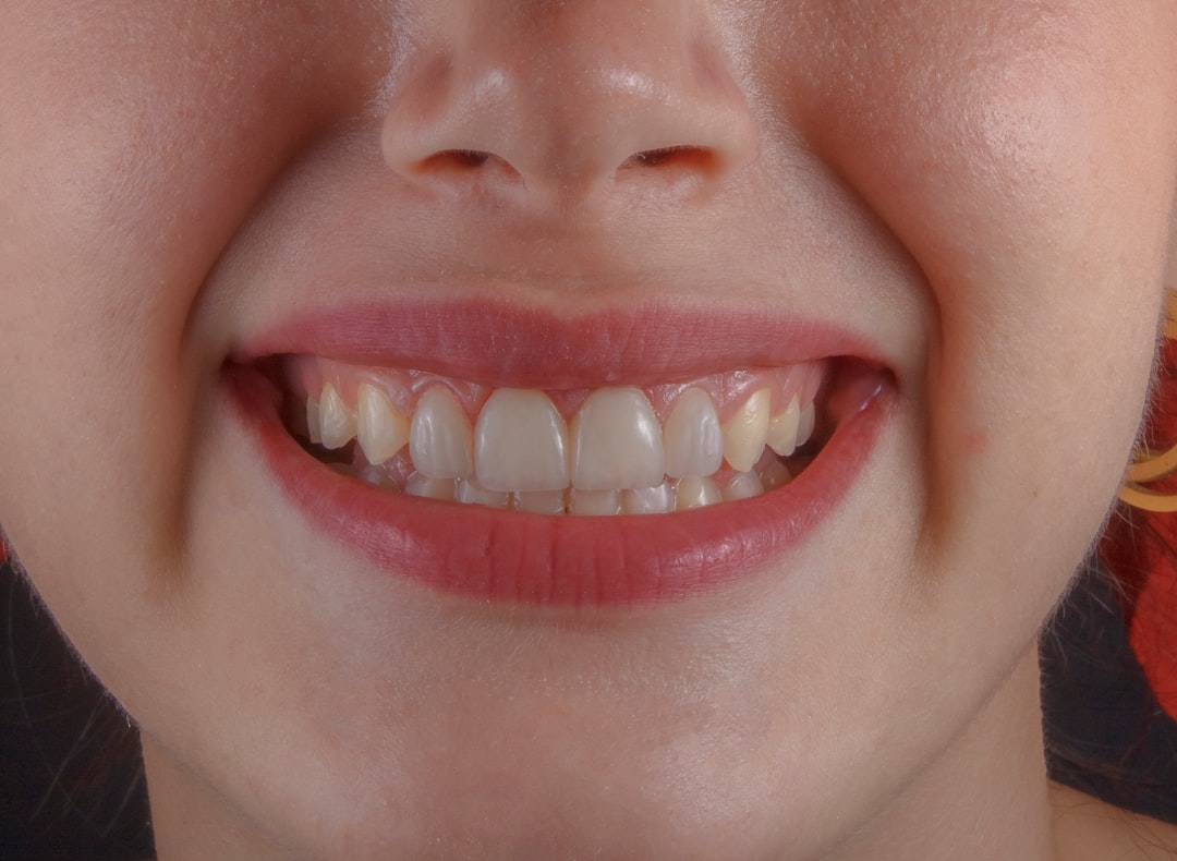 The Ultimate Guide to Natural Looking Dentures: Make Your Best Choice
