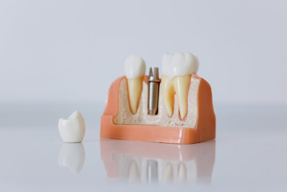 Where to Get Snap-On Dentures: A Local Search Guide