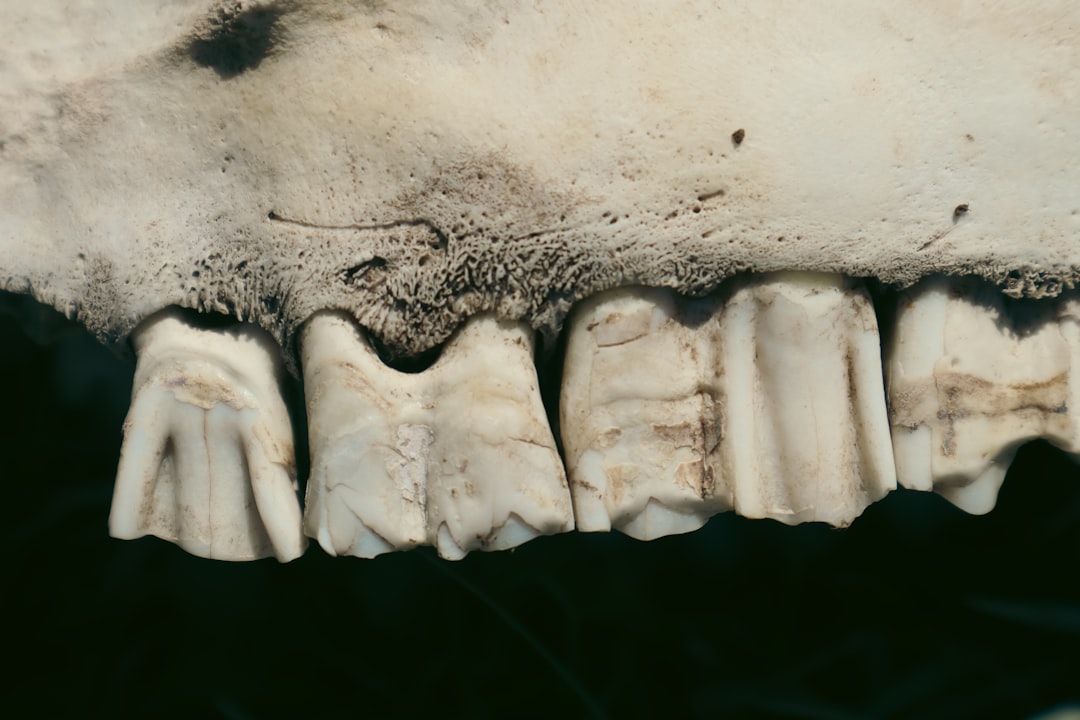 Choosing Your Smile: A Guide to Partial Denture Types and Costs
