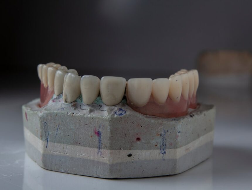 Dental Implants Near Me: Get the Best Price in Your Area