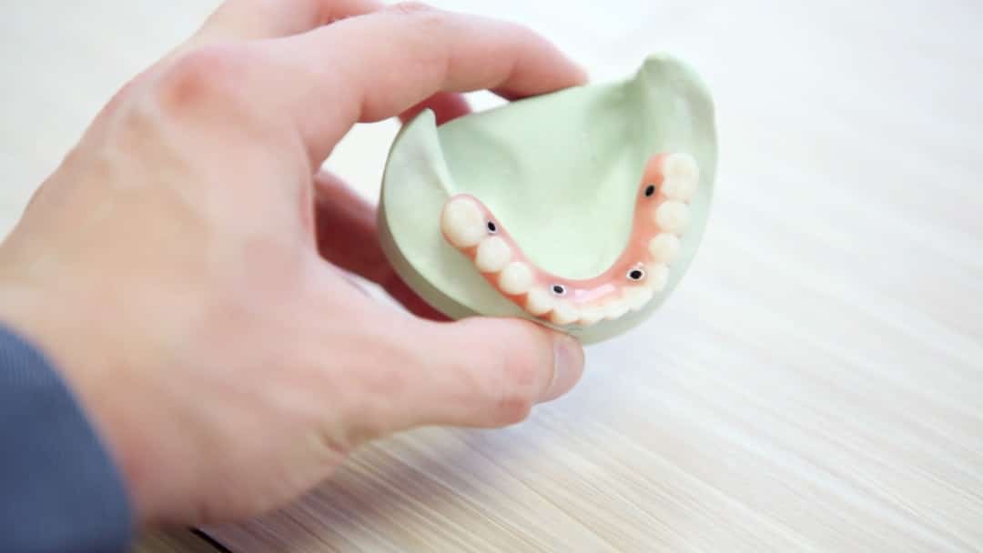 How Much Will Your Dental Bridge Set You Back?