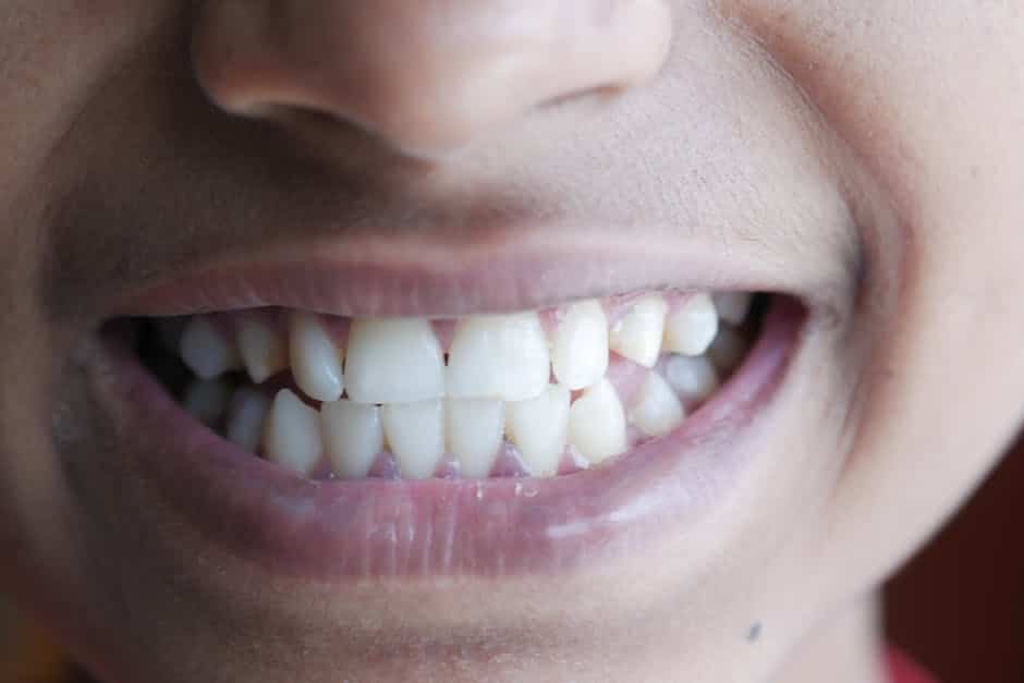 Dental Restoration: Unveiling the True Cost of a Healthy Smile
