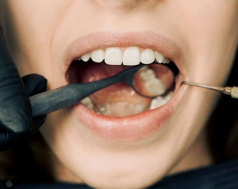 The Buzz About Ultrasonic Dental Cleaning: A Deeper Dive