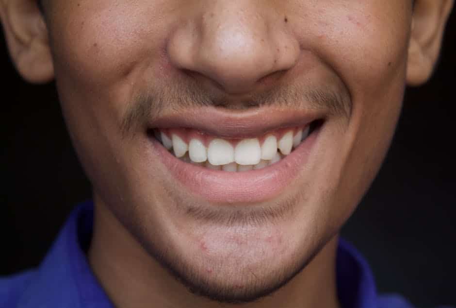 The Cost of Confidence: Making Permanent Teeth Affordable