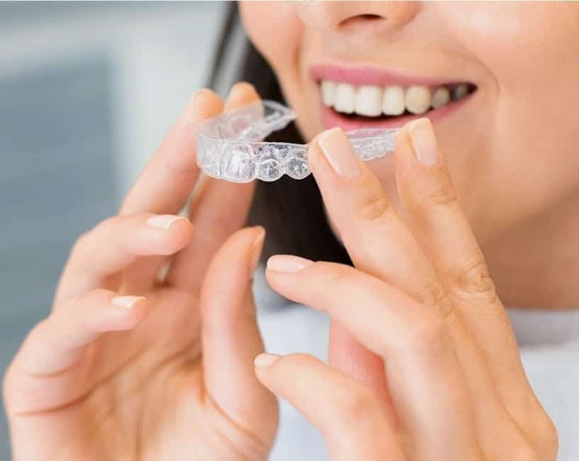 Clear Aligners Your Path to a Perfect Smile Without Braces