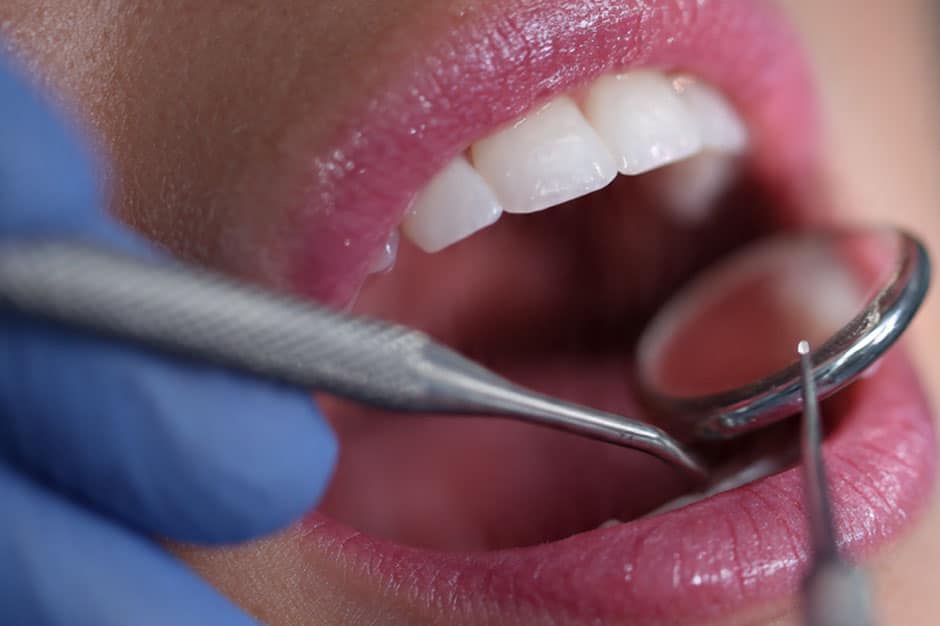 gum disease cleaning lemont palos hills