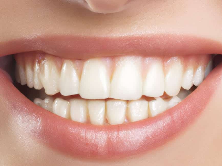 Your Guide to Finding Top-Rated Teeth Whitening Treatments Nearby