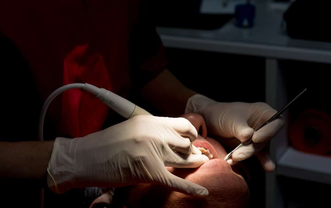 Dental Cleaning: Process, Benefits, and Cost Unpacked