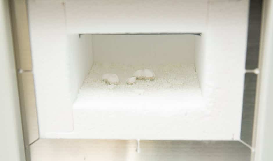 Modern Denture Technology and the Materials That Make It Work