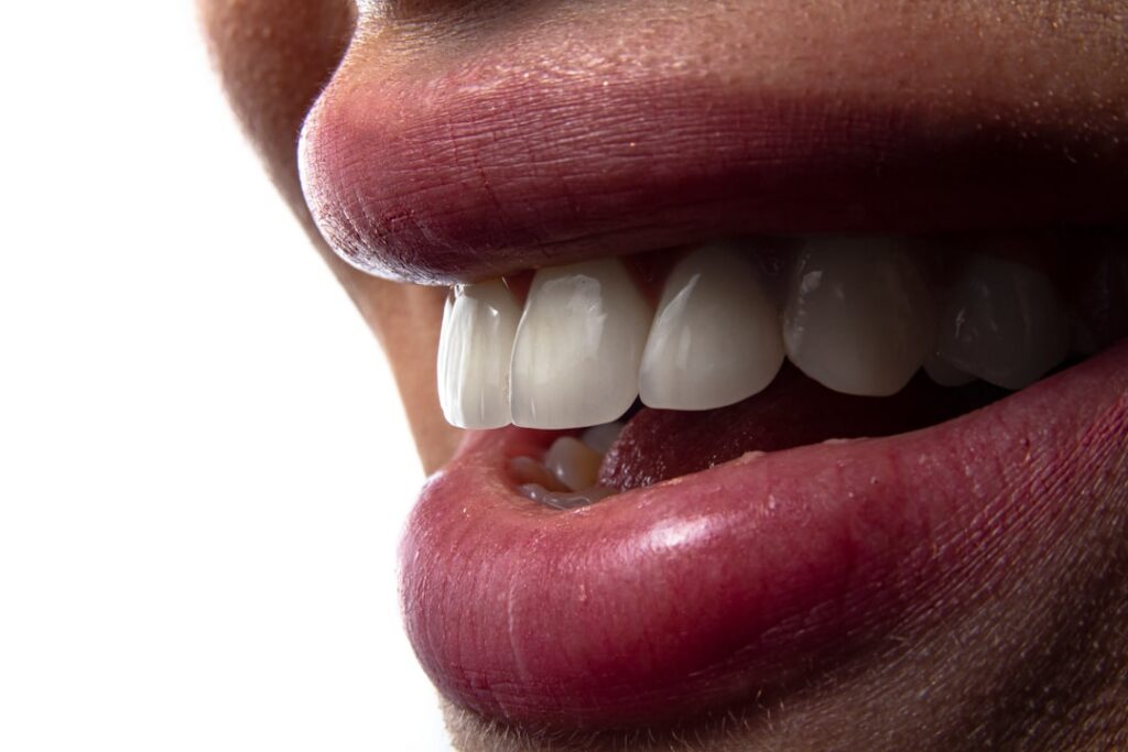 remove tobacco stains from teeth