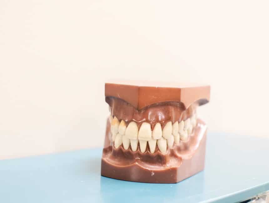 Why you dont have to spend a fortune on new dentures