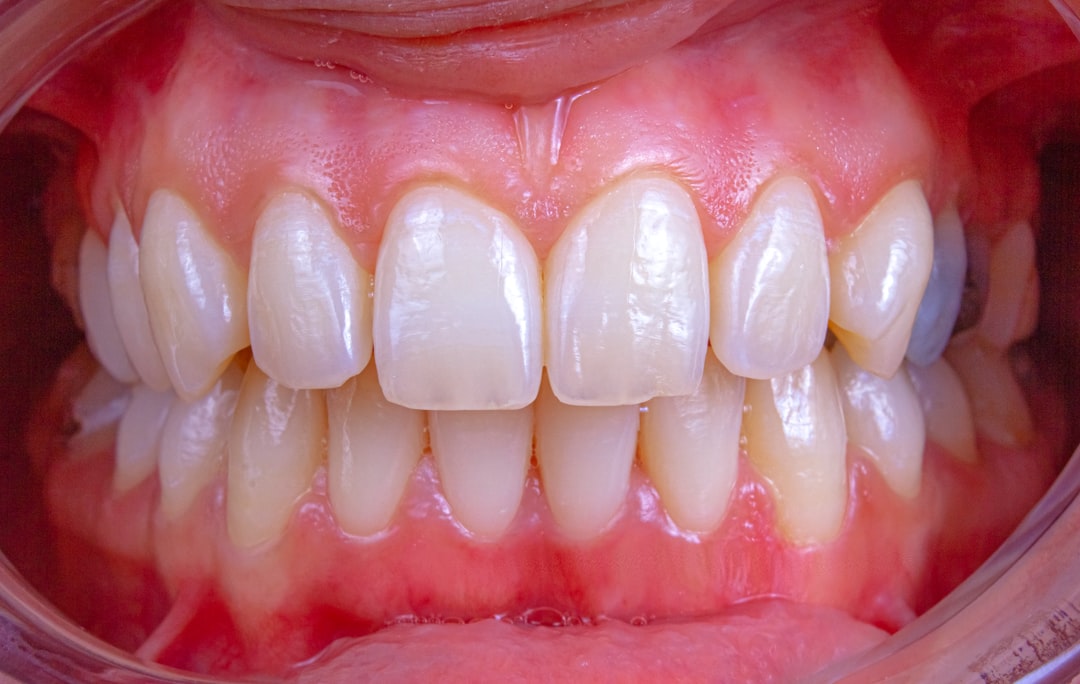 Affordable Gum Disease Solutions That Won’t Break the Bank