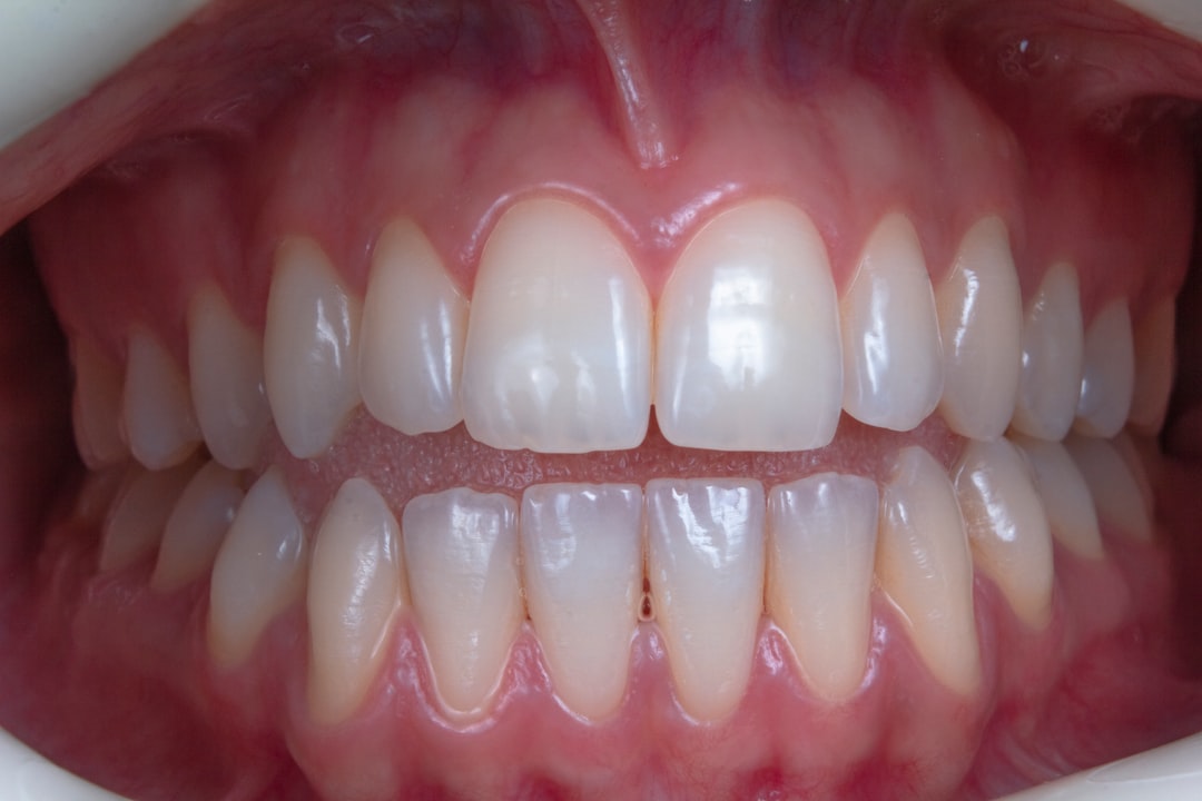 The best places to get teeth whitened near me right now