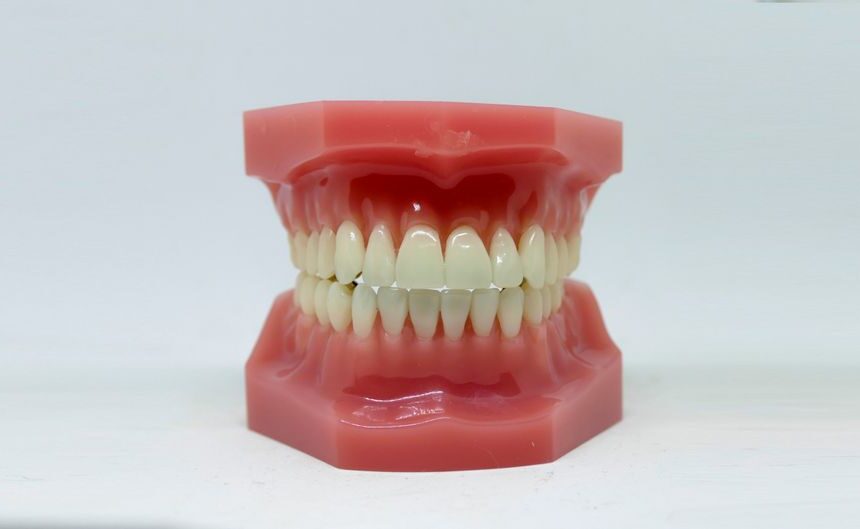 A Guide to Your Upper Teeth and Dental Arches