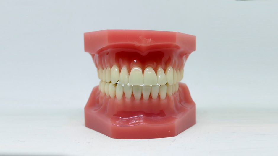 A Guide to Your Upper Teeth and Dental Arches