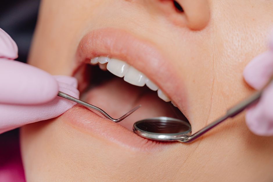 Plaque Removal Near Me: Your Guide to Professional Teeth Cleaning