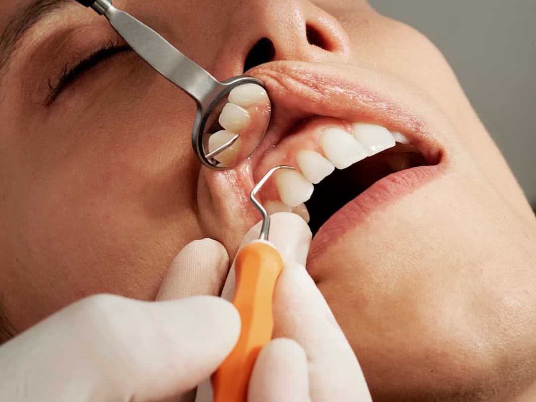 Teeth Stain Removal Dentist Guide: From Yellow to Mellow