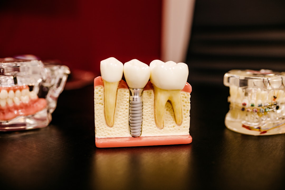 Beginner’s Guide to Dental Implants Cost