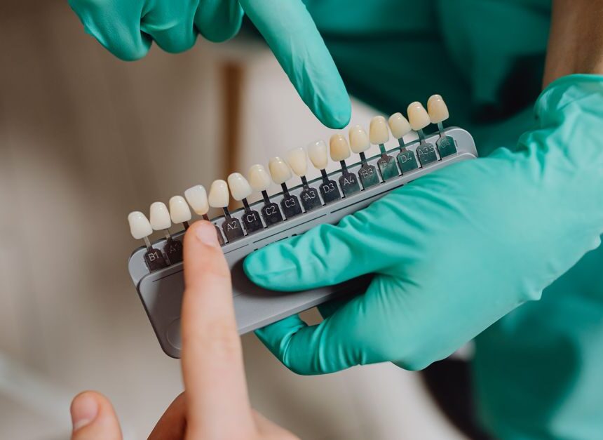 Local Dentist Teeth Whitening: Get a Brighter Smile Without the DIY Drama