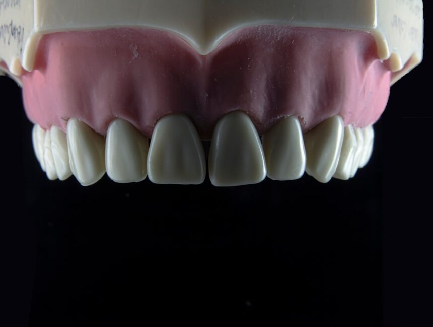Denture Material Options Compared: A Beginner’s Guide
