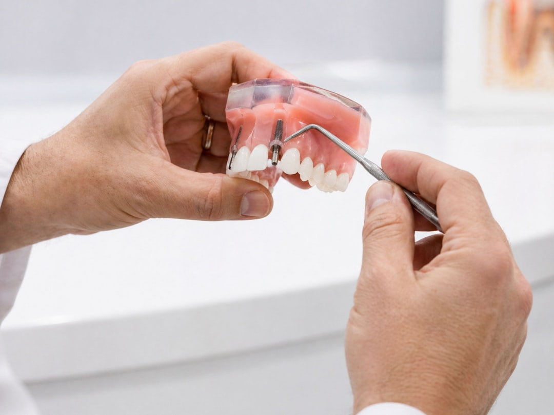 In Depth Guide to Dental Implants vs False Teeth