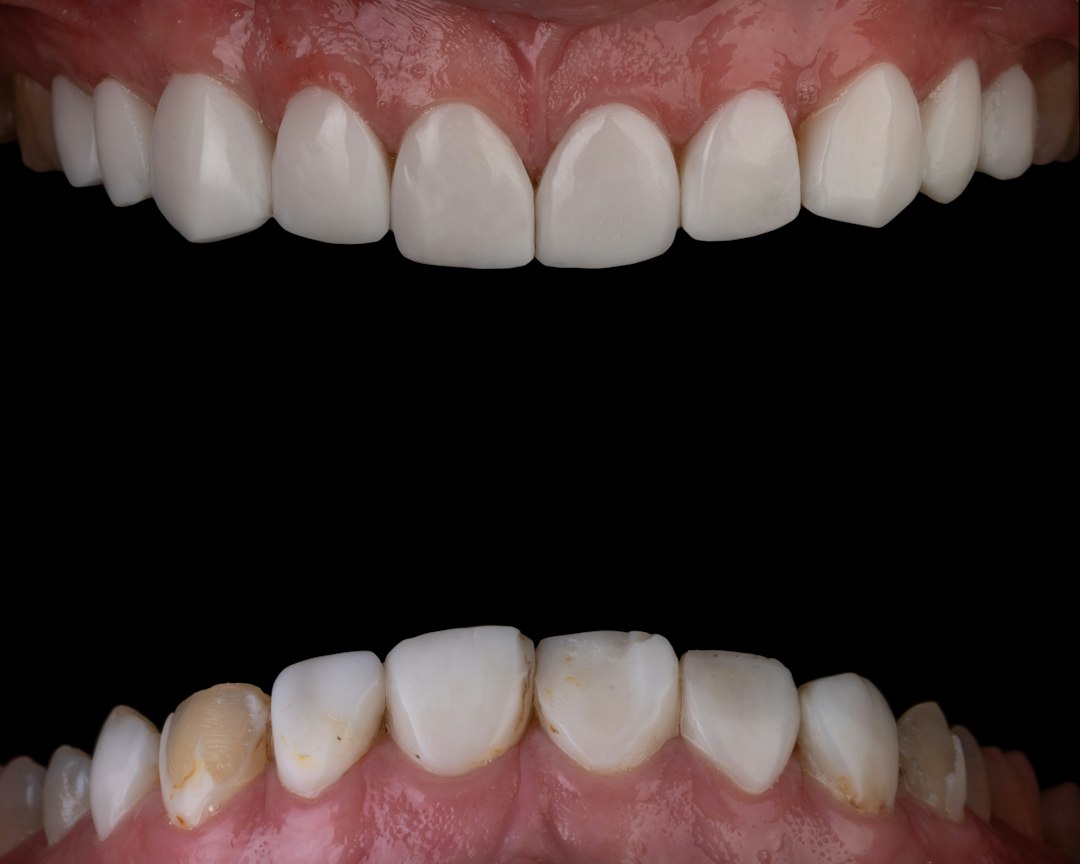 Affordable Teeth Whitening Near You: A Practical Guide to Budget Brightening
