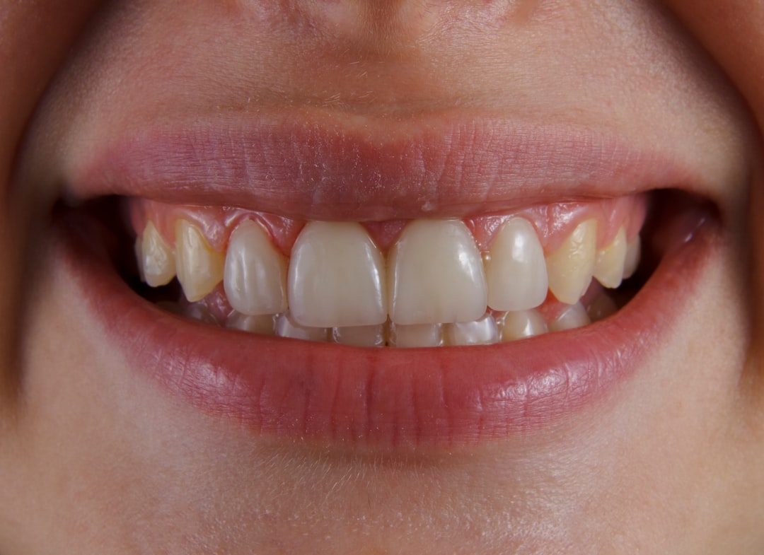 Don’t Scrape That! How to Handle Stubborn Tartar
