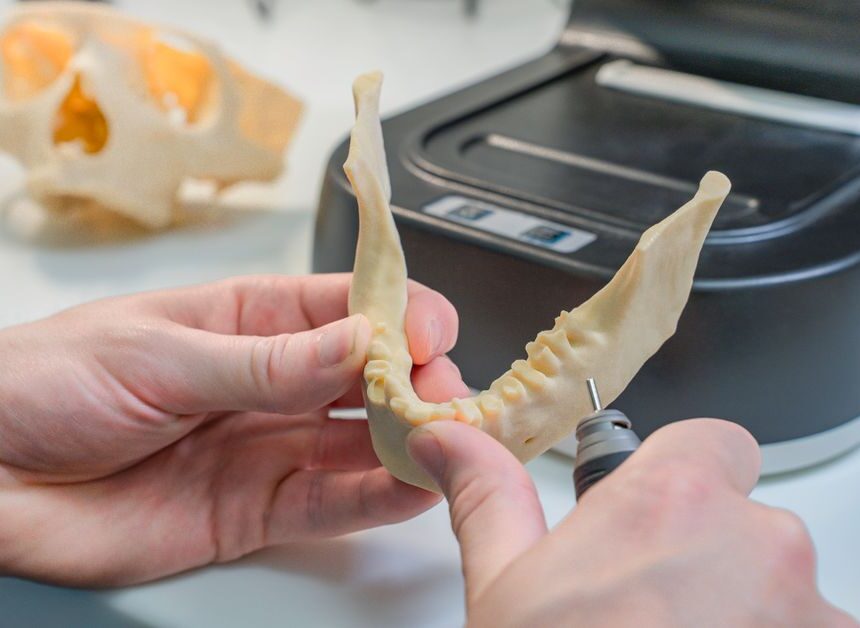 The Smart Patient Guide to Advanced Tooth Bridge Costs