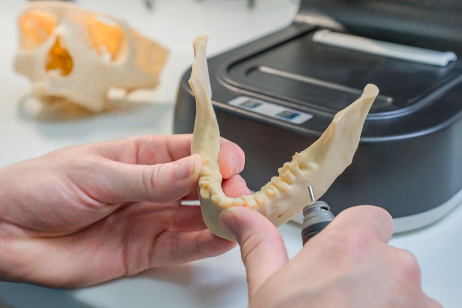 The Smart Patient Guide to Advanced Tooth Bridge Costs